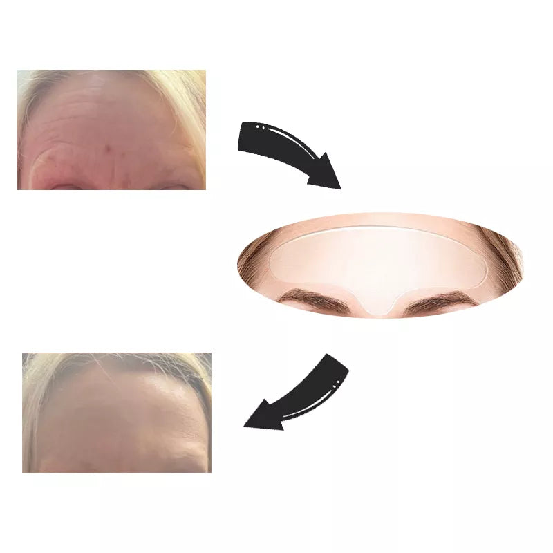 Adesivo de silicone anti rugas e linhas de expressão