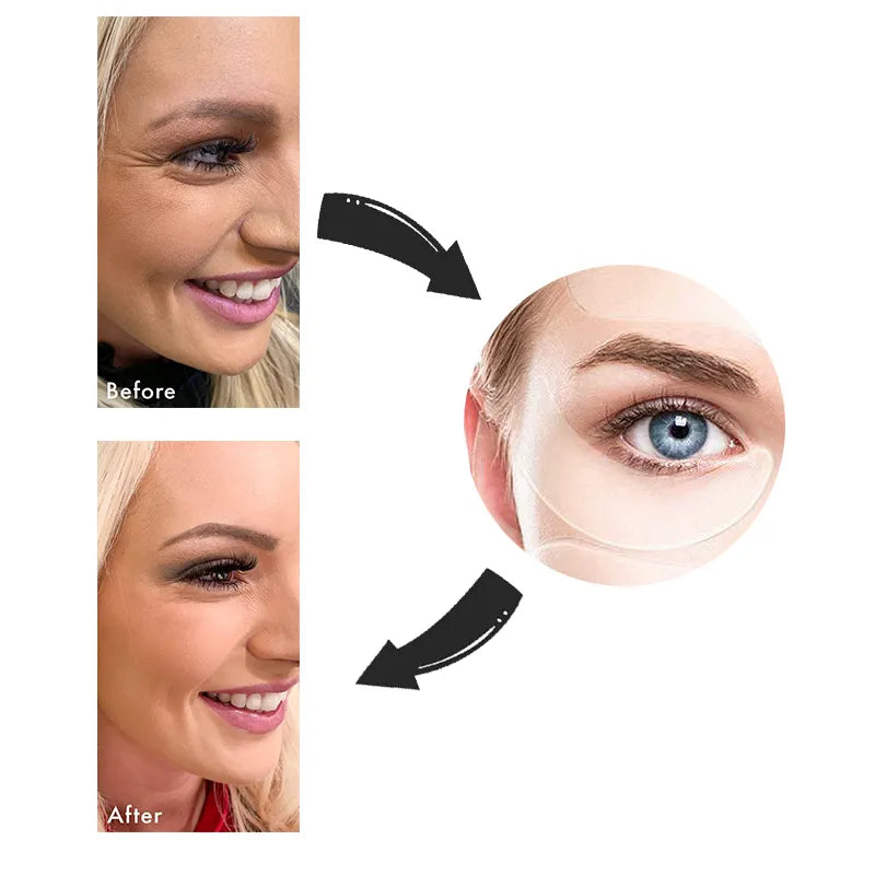 Adesivo de silicone anti rugas e linhas de expressão